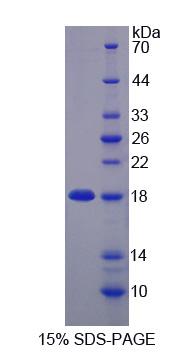 含锌飘带域蛋白1(ZNRD1)重组蛋白,Recombinant Zinc Ribbon Domain Containing Protein 1 (ZNRD1)