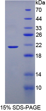 含溴区蛋白8(BRD8)重组蛋白,Recombinant Bromodomain Containing Protein 8 (BRD8)