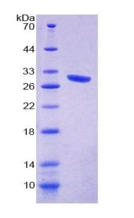 含血管性血友病因子A域蛋白1(vWA1)重組蛋白,Recombinant Von Willebrand Factor A Domain Containing Protein 1 (vWA1)