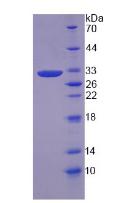 含血管性血友病因子A域蛋白2(vWA2)重组蛋白,Recombinant Von Willebrand Factor A Domain Containing Protein 2 (vWA2)