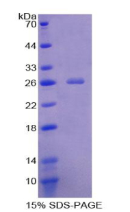 含血管性血友病因子A域蛋白3A(vWA3A)重組蛋白,Recombinant Von Willebrand Factor A Domain Containing Protein 3A (vWA3A)