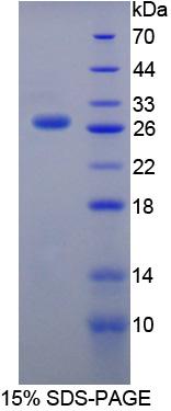 含硬化蛋白域蛋白1(SOSTDC1)重组蛋白,Recombinant Sclerostin Domain Containing Protein 1 (SOSTDC1)