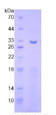 含整合素αFG GAP重复蛋白1(ITFG1)重组蛋白,Recombinant Integrin Alpha FG GAP Repeat Containing Protein 1 (ITFG1)