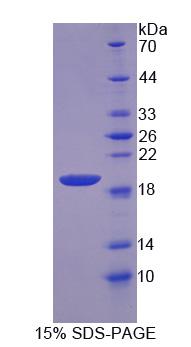 核分布基因C同源物(NUDC)重组蛋白,Recombinant Nuclear Distribution Gene C Homolog (NUDC)