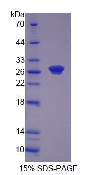 核苷酸还原酶M1(RRM1)重组蛋白,Recombinant Ribonucleotide Reductase M1 (RRM1)