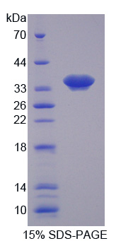 核膜含血影蛋白重复蛋白1(Nesp1)重组蛋白,Recombinant Nesprin 1 (Nesp1)