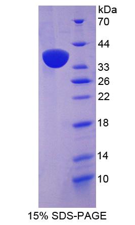 核膜含血影蛋白重复蛋白2(Nesp2)重组蛋白,Recombinant Nesprin 2 (Nesp2)