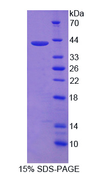 核受體相關(guān)蛋白1(NURR1)重組蛋白,Recombinant Nuclear Receptor Related Protein 1 (NURR1)