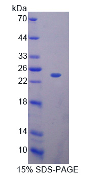 核糖核酸酶A11(RNASE11)重组蛋白,Recombinant Ribonuclease A11 (RNASE11)