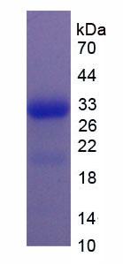 核糖核酸酶A2(RNASE2)重组蛋白,Recombinant Ribonuclease A2 (RNASE2)