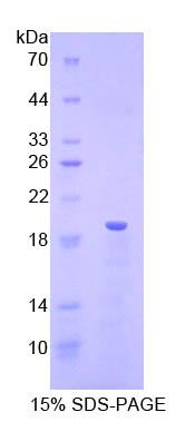 核糖核酸酶A3(RNASE3)重组蛋白,Recombinant Ribonuclease A3 (RNASE3)