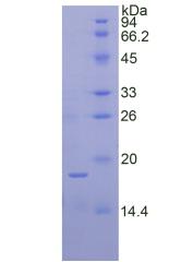 核糖核酸酶A7(RNASE7)重组蛋白,Recombinant Ribonuclease A7 (RNASE7)