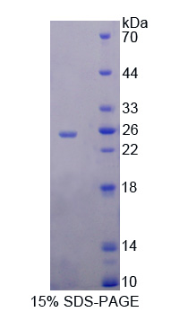 核糖核酸酶A9(RNASE9)重组蛋白,Recombinant Ribonuclease A9 (RNASE9)