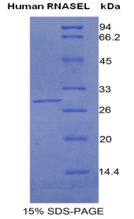 核糖核酸酶L(RNASEL)重組蛋白,Recombinant Ribonuclease L (RNASEL)