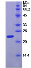 核糖核酸酶P(RNASEP)重組蛋白,Recombinant Ribonuclease P (RNASEP)