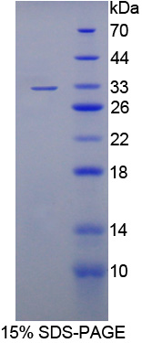 核糖体蛋白L13A(kl13A)重组蛋白,Recombinant Ribophorin I (RPN1)