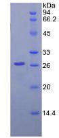 核纤层蛋白B1(LMNB1)重组蛋白,Recombinant Lamin B1 (LMNB1)