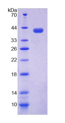 核小體裝配蛋白1樣1(NAP1L1)重組蛋白,Recombinant Nucleosome Assembly Protein 1 Like Protein 1 (NAP1L1)