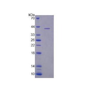 含NLR家族Pyrin域蛋白3(NLRP3)重组蛋白