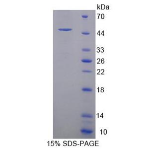 含PR域蛋白14(PRDM14)重组蛋白
