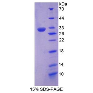 含RNA结合冷休克域蛋白E1(CSDE1)重组蛋白