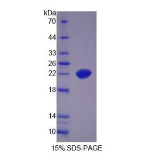 含SCAN域蛋白3(SCAND3)重组蛋白