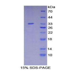 含Src同源物2域適配蛋白B(SHB)重組蛋白,Recombinant Src Homology 2 Domain Containing Adapter Protein B (SHB)