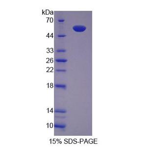 含TCP1伴侣蛋白亚基2(CCT2)重组蛋白,Recombinant Chaperonin Containing TCP1, Subunit 2 (CCT2)