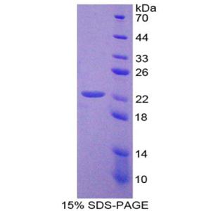 含杆状病毒IAP重复蛋白2(BIRC2)重组蛋白