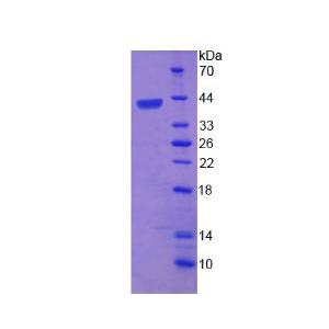 含杆状病毒IAP重复蛋白6(BIRC6)重组蛋白