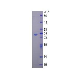 含亮氨酸丰富重复死亡域蛋白(LRDD)重组蛋白,Recombinant Leucine Rich Repeats And Death Domain Containing Protein (LRDD)