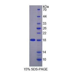 含锌飘带域蛋白1(ZNRD1)重组蛋白,Recombinant Zinc Ribbon Domain Containing Protein 1 (ZNRD1)