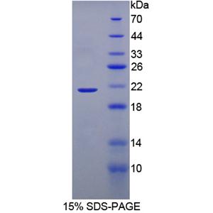 含溴区蛋白8(BRD8)重组蛋白,Recombinant Bromodomain Containing Protein 8 (BRD8)