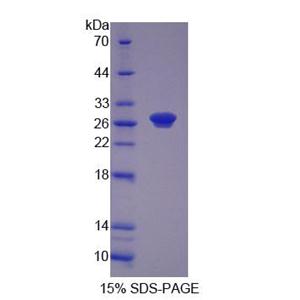 核苷酸还原酶M1(RRM1)重组蛋白,Recombinant Ribonucleotide Reductase M1 (RRM1)