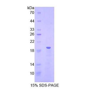 核糖核酸酶A3(RNASE3)重组蛋白