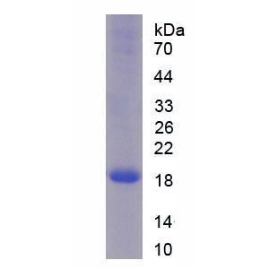 核糖核酸酶A8(RNASE8)重组蛋白