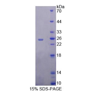 核糖核酸酶A9(RNASE9)重组蛋白,Recombinant Ribonuclease A9 (RNASE9)