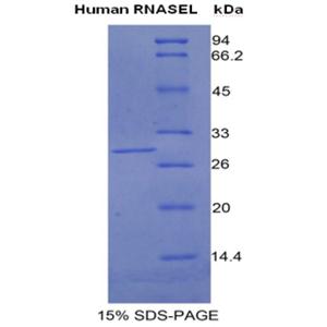 核糖核酸酶L(RNASEL)重組蛋白,Recombinant Ribonuclease L (RNASEL)