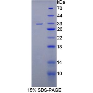 核糖体蛋白L13A(kl13A)重组蛋白