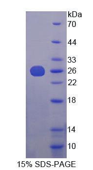 赫曼斯基普德拉克綜合征蛋白4(HPS4)重組蛋白,Recombinant Hermansky Pudlak Syndrome Protein 4 (HPS4)