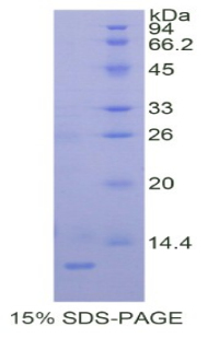 黑色素瘤優(yōu)先表達(dá)抗原(PRAME)重組蛋白,Recombinant Preferentially Expressed Antigen In Melanoma (PRAME)