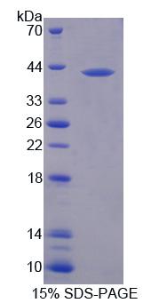 黑素转铁蛋白(MFI2)重组蛋白,Recombinant Melanotransferrin (MFI2)