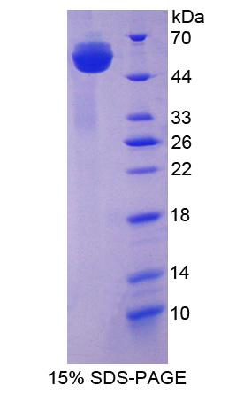 亨廷顿关联蛋白1(HAP1)重组蛋白,Recombinant Huntingtin Associated Protein 1 (HAP1)