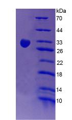 红细胞补体受体1(CR1)重组蛋白,Recombinant Complement Receptor 1, Erythrocyte (CR1)