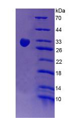 紅細胞補體受體1(CR1)重組蛋白,Recombinant Complement Receptor 1, Erythrocyte (CR1)