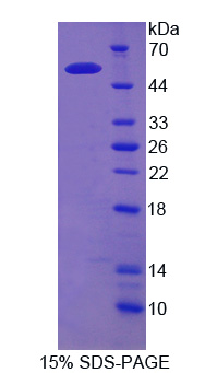 红细胞膜蛋白带4.2(EPB42)重组蛋白,Recombinant Erythrocyte Membrane Protein Band 4.2 (EPB42)