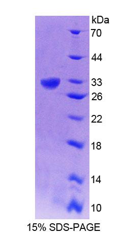 红藻氨酸离子能谷氨酸受体2(GRIK2)重组蛋白,Recombinant Glutamate Receptor, Ionotropic, Kainate 2 (GRIK2)