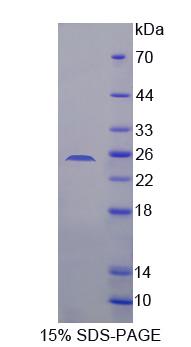 琥珀酸脫氫酶復合體B亞基(SDHB)重組蛋白,Recombinant Succinate Dehydrogenase Complex Subunit B (SDHB)