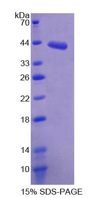 琥珀酸脱氢酶复合体C亚基(SDHC)重组蛋白,Recombinant Succinate Dehydrogenase Complex Subunit C (SDHC)