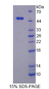 環(huán)指蛋白39(RNF39)重組蛋白,Recombinant Ring Finger Protein 39 (RNF39)